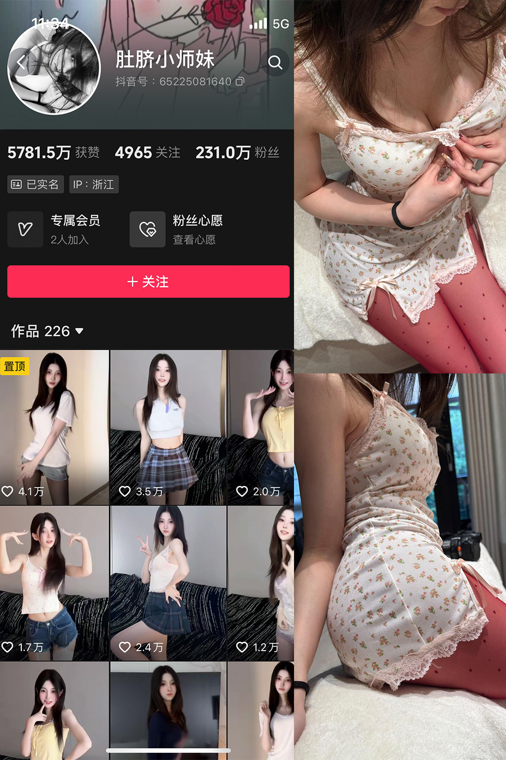 抖音 肚脐小师妹 微密圈  NO.037期 【15P2V】最新至：2025.4.13-艺库